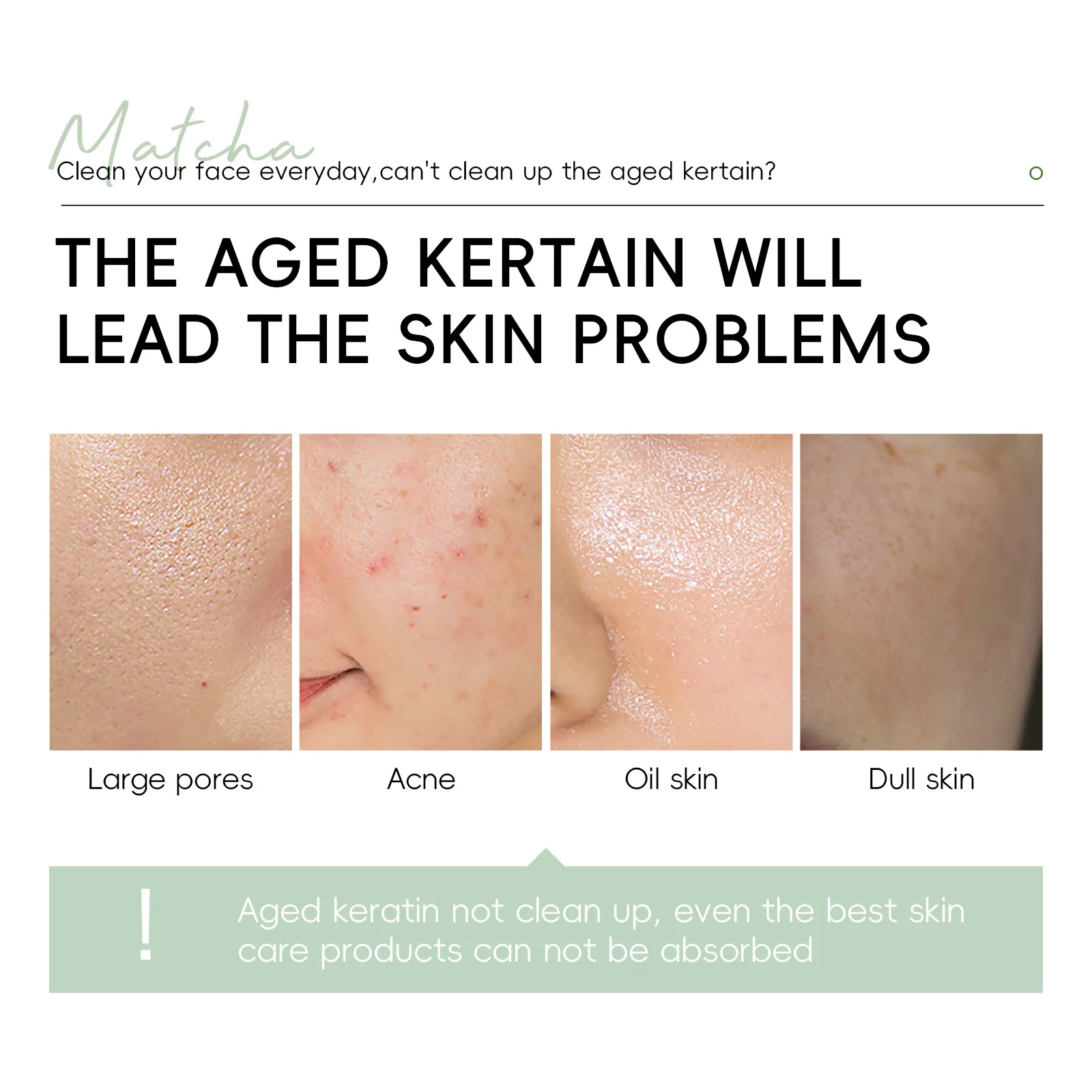 LAIKOU ماتشا التقشير جل التقشير تقشير جل الوجه فرك ترطيب مغذي إصلاح الدعك الكورية كريم وجه العناية بالبشرة