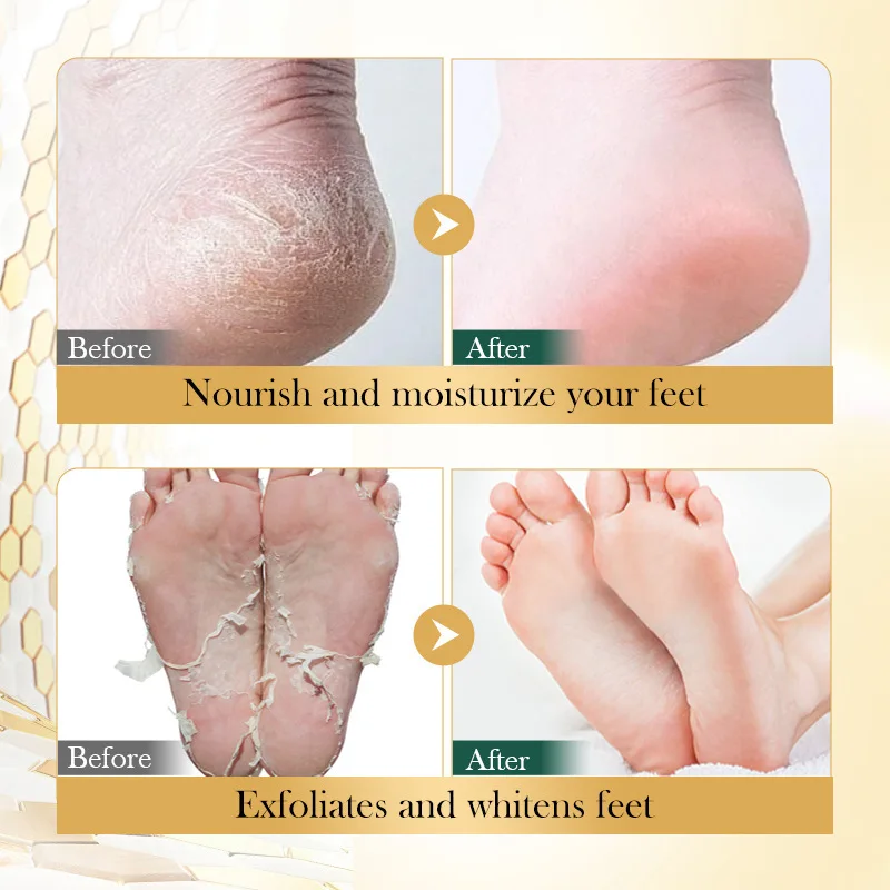 Vitamin E Foot Mask Manuka Honey Nourishing Long-lasting Moisturizing Hydrating Exfoliating Remove Dead Skin Foot Skin Care