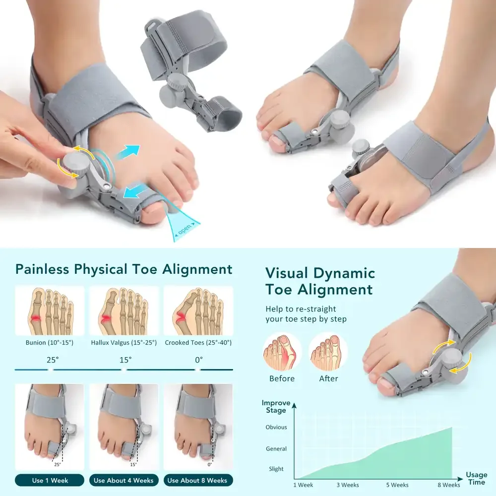 

WAP01 Bunion Corrector Adjustable Hallux Valgu Big Toe Valgus Corrector Rotatable Toe Corrector Straightener Toe Correction