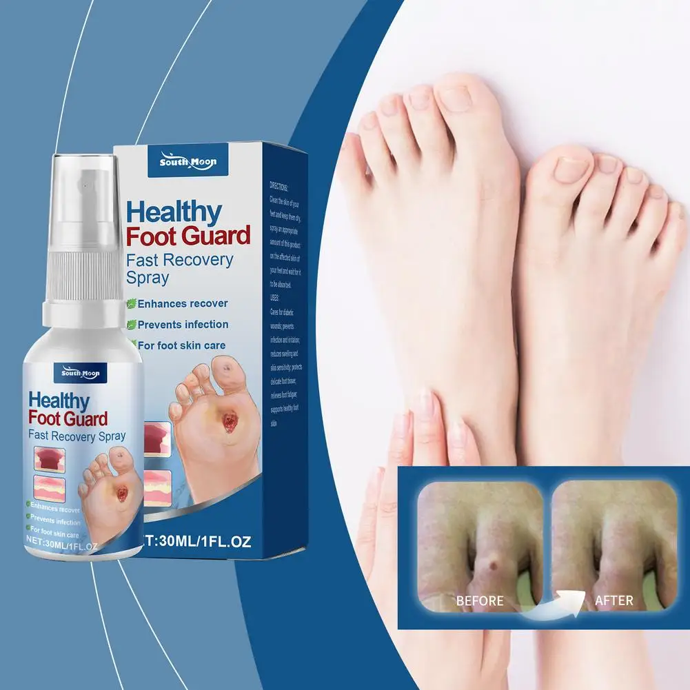 Semprotan Penghilang Kalus Kaki dengan Cepat Melembutkan Pengelupasan Kulit Kapalan Kaki Membersihkan Kulit Mati Hidrasi Kulit Kaki Kutikula Perawatan Perbaikan X4A9
