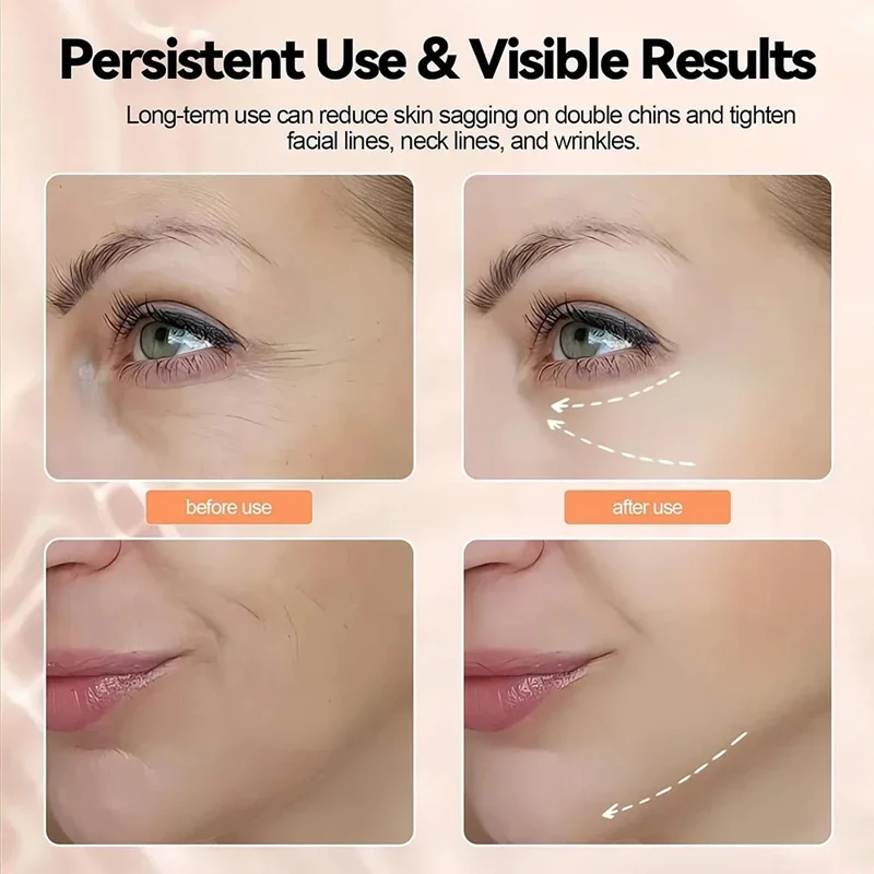 EMS Neck Photon Beauty Lifting Machine Facial Treatment Massager Tightening Double Chin Anti Wrinkle Neck Lifting Beauty Device