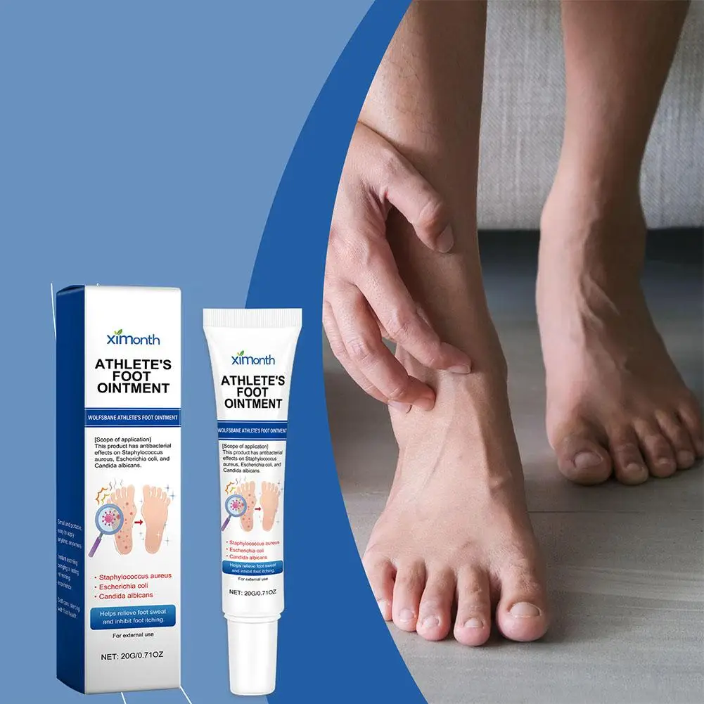 Pommade pour les pieds d'athlète, anti-fongique, peeling, tinea, sans doigts, anti-gonflement, avec poignées, en forme de bœuf, soins de santé