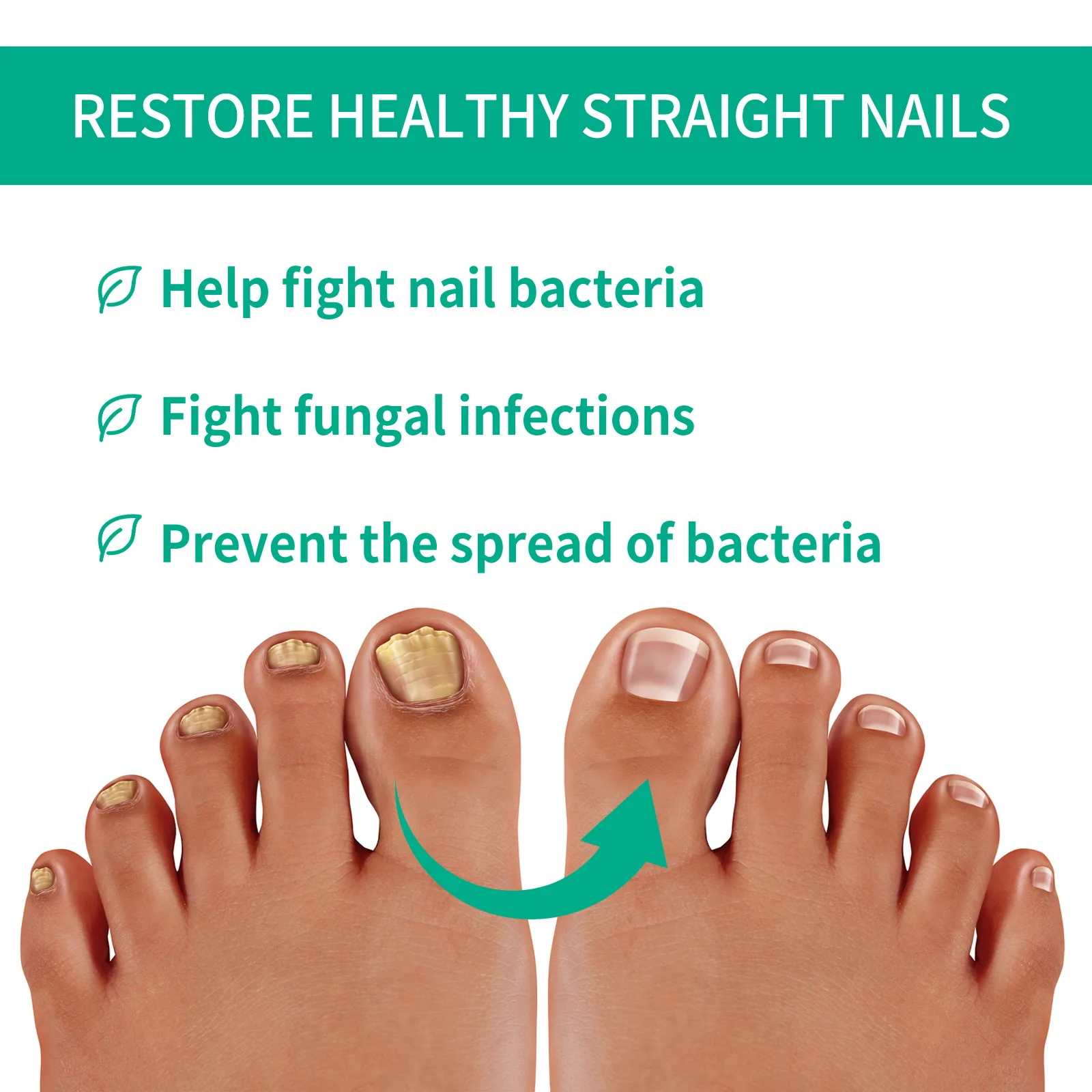 Extra forte tratamento de fungos nas unhas soro essência óleo cuidados reparação essência anti infecção do dedo do pé gel pés creme remoção unhas fungos