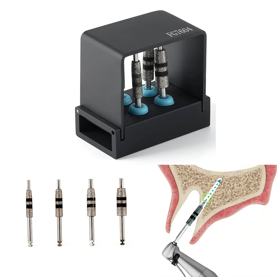 

Стоматологический имплантологический сверлильный инструмент для направляемой хирургии, тип FG, с регулировкой по высоте, для подготовки имплантатов, пилотный сверлильный инструмент