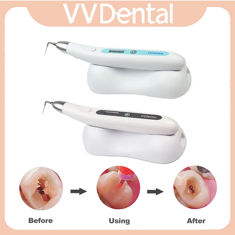 VVDental Endo Activator With LED Light For Endodontic Treatment Cleaning Root Canal Sonic Irrigator 5pcs Tips Dental Instrument