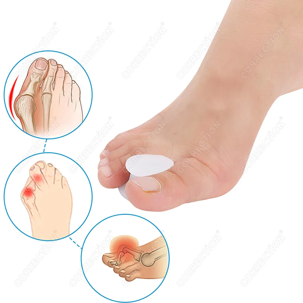 CORRECTION Silicone Toes Separator Bunion Bone Ectropion Adjuster Toes Outer Appliance Foot Care Tools Hallux Valgus Corrector