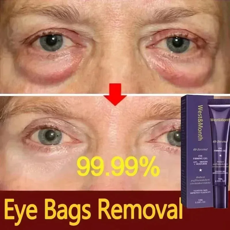 

Instant Eye Bag Removing Cream Retinol Anti wrinkle Firming Skin Fading Thin Line Anti dark Round puffing Whitening Eye Care gel