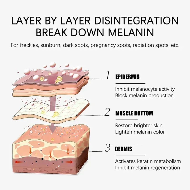 เมลานิน-ลบเซรั่มไวท์เทนนิ่งจุดด่างดำฝ้ากระ chloasma เพิ่มความชุ่มชื้นและซ่อมแซมผิวหน้า