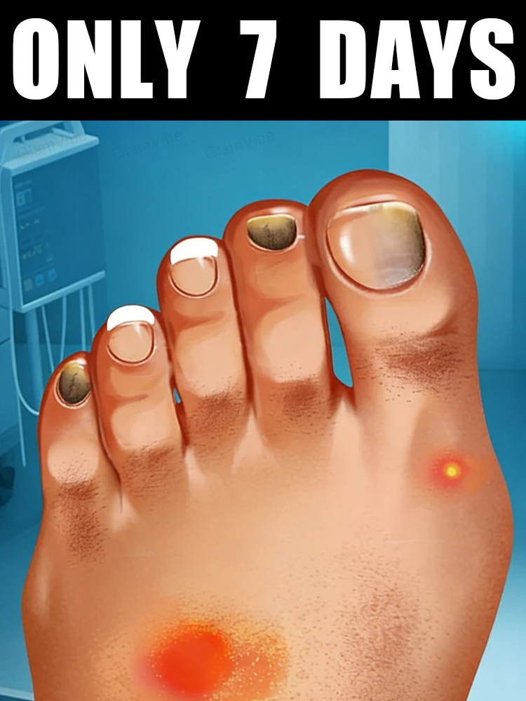 2026 Limited Offer! Free Shipping! Tea Tree Nail Solution 10ml