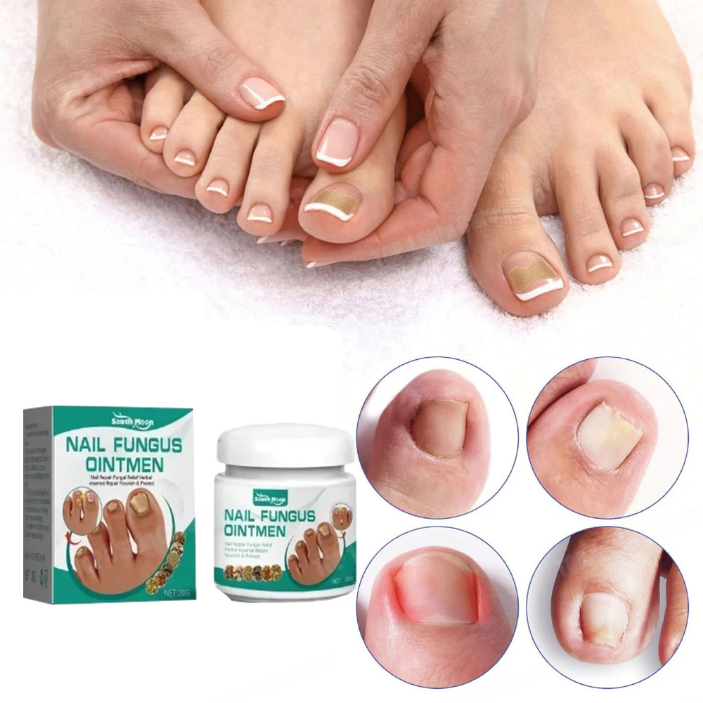 Fungal nail removing fungus nail care oil foot repair essence toenail fungus removing gel anti infection cream