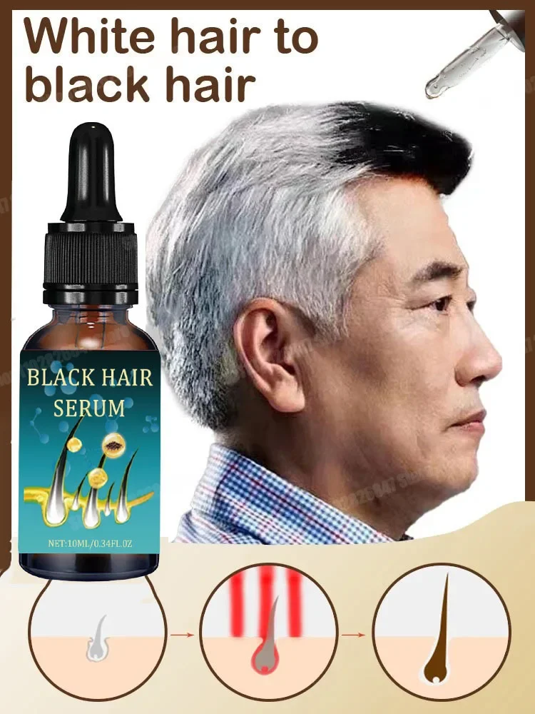 Revitalize Your Hair Color and Health with Anti-Grey Hair Natural Anti-Grey Serum Remedy  Healthy Essence Serum