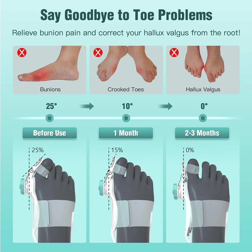 Bunion Corrector Adjustable Hallux Valgu Big Toe Valgus Corrector Rotatable Toe Corrector Straightener Adjustable Toe Correction