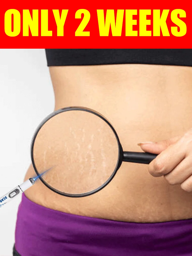 Strumenti per la cura della pelle dopo il parto Prodotti per smagliature corporee