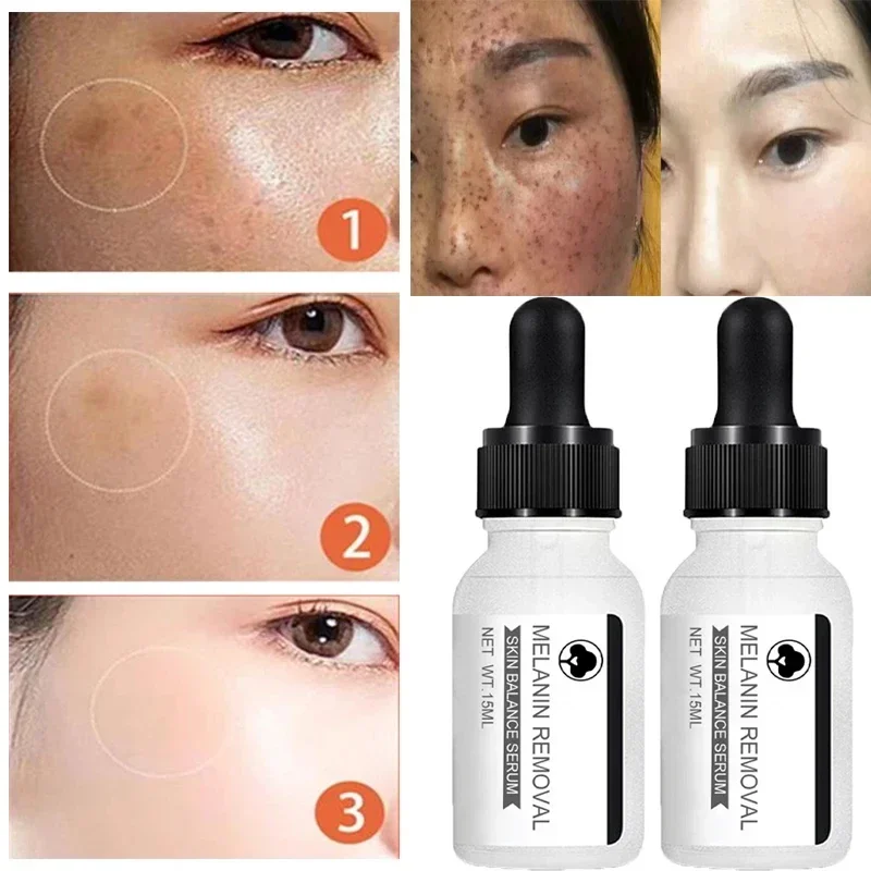 Niacinamide Donkere Vlek Verwijderen Serum Anti-Aging Heldere Sproet Witter Huid Crème Vervagen Pigmentatie Melasma Vocht Gezicht Huidverzorging