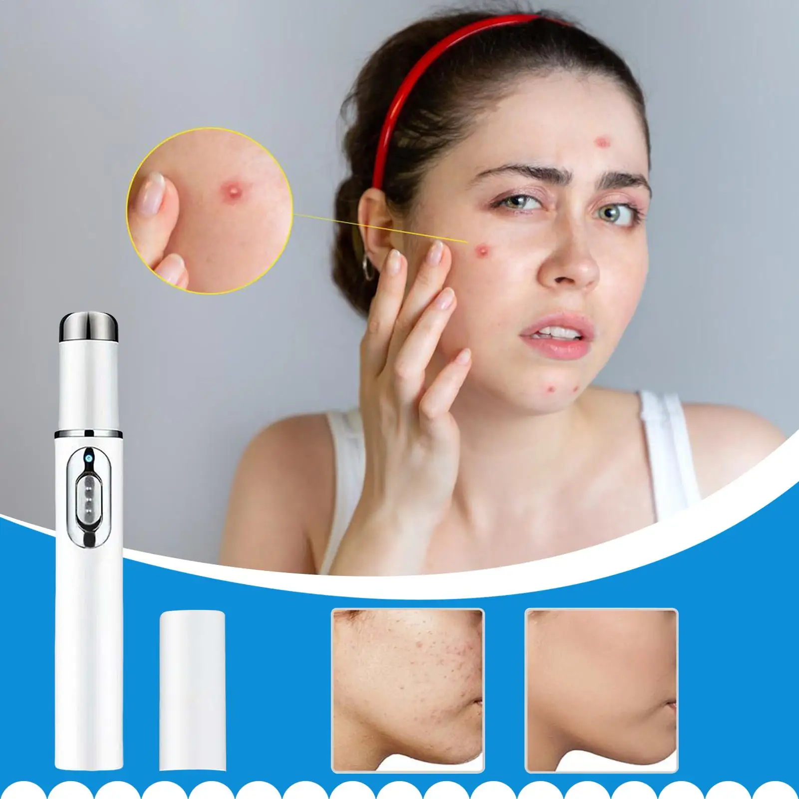 Mol Remover Pen Draagbare Huid Pen Vrouwen Accessoire voor Gezicht Elleboog Prive Zon Billen Terug Binnenkant Oksel Dijen Benen Borst