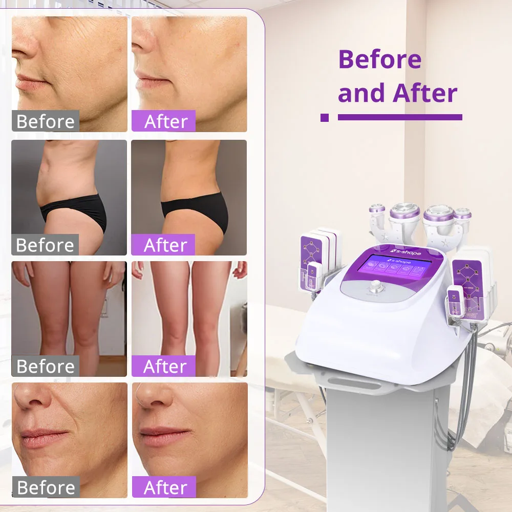 S Shape Machine 30K Body Shape EL EMS RF Face Lift Adipose  Reduce Laser Machine