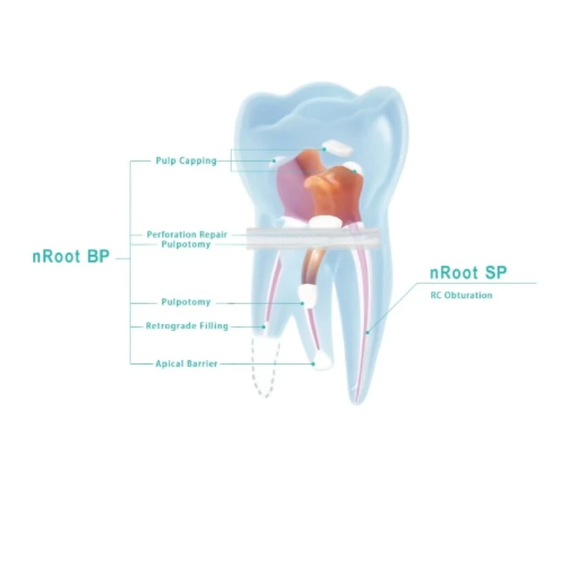 0.5/2g Dental SP NRoot Endo Filling Injectable Bioceramic Root Canal Sealer Endodontic Sealing Material Root Canal Filling Paste