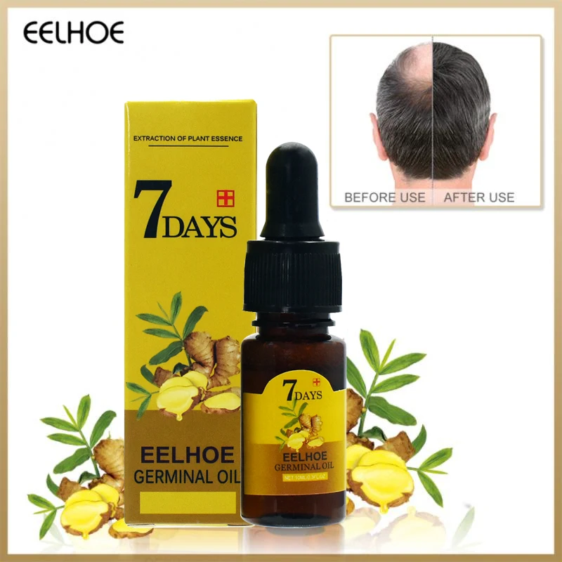 Ginger Hair Growth Essential Oils Serum Fast Hair Regrowth 7 Days Anti-loss Repair Damaged Hair Strong The Root of Hair Care view 5