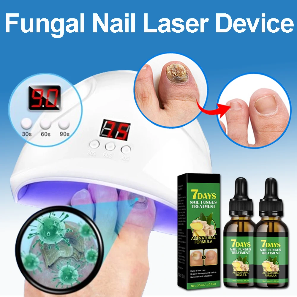 Fungal Nail Laser Device Repair Fast Nails Fungus Anti Infection Paronychia Onychomycosis Ingrown Toenail Foot Care Device