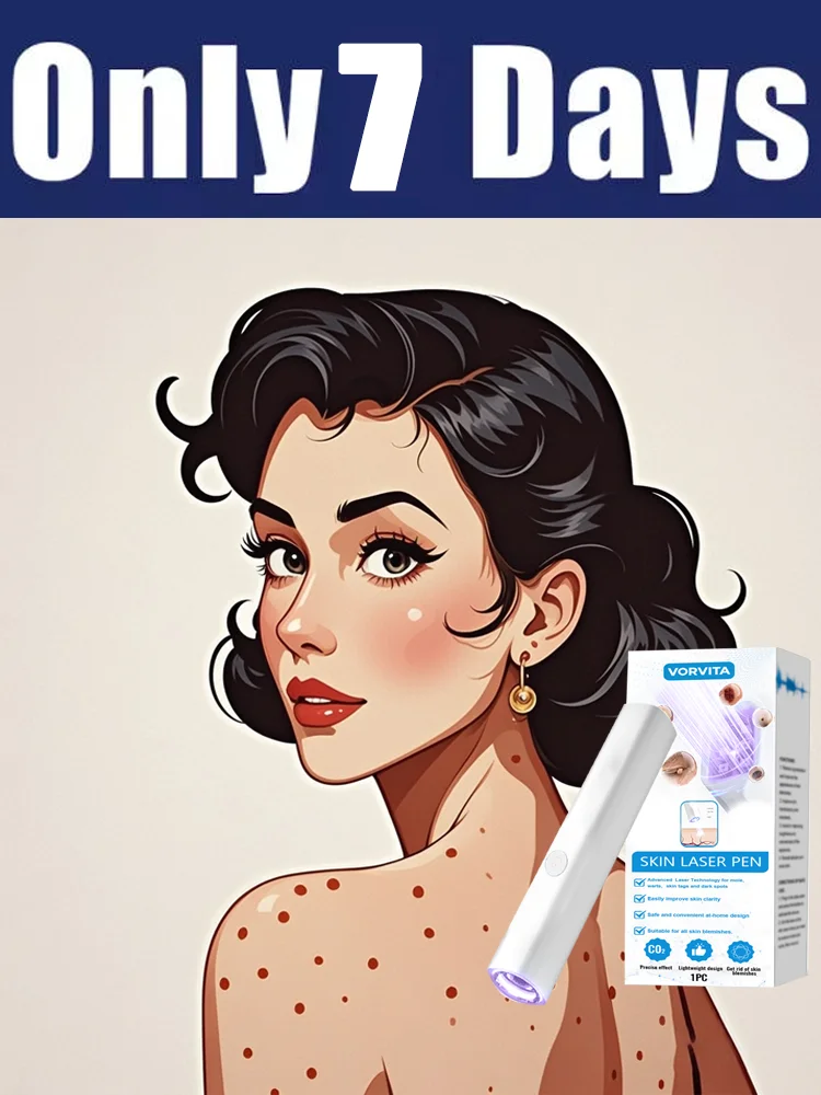 

2nd ᵍᵉⁿᵉʳᵃᵗⁱᵒⁿ ᵘᵖᵍʳᵃᵈᵉᵈ wᵃʳᵗ ⸴ ᑫᵘⁱᶜᵏˡʸ， ʳᵉpᵃⁱʳ wᵃʳᵗˢ ʳᵒoᵗ 88