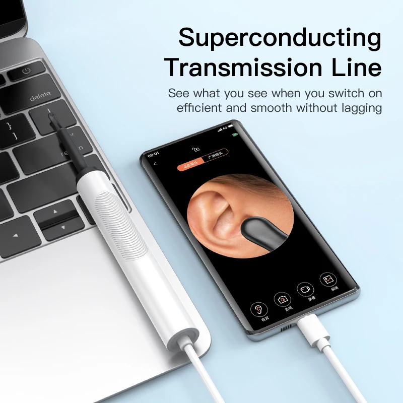 Ear Cleaner with Camera Ear Sticks Otoscope USB Type-C Andrid Charging Endoscope Wax Removal Tool Earpick Camera Health Care