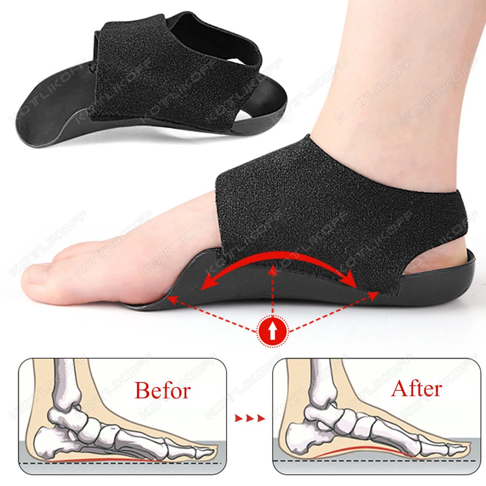 KOTLIKOFF Arch Support Orthopedic Insole For Walk With Arch Half Pad X/O Type Leg With Velcro Strap Wearable Shoe Heel Cover image 2
