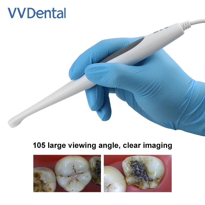 

VV Dental LED Intraoral Camera USB Connect High Resolution 1/4 CMOS 13.0 Mega Pixels Lens for Oral Examination