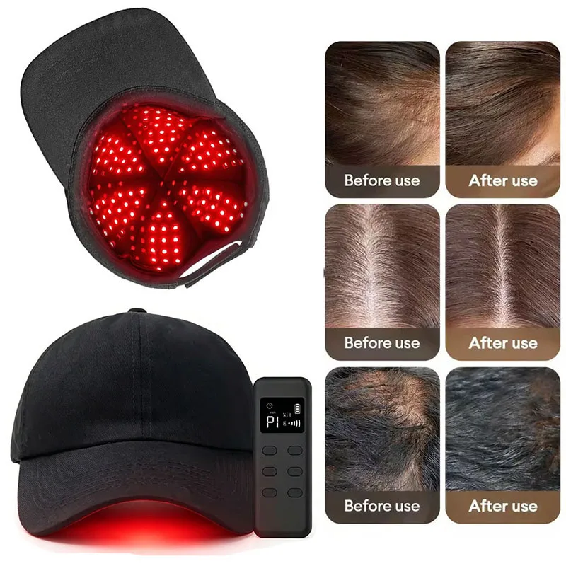 LED Red Light Therapy Hat For Hair Growth Red & Infrared Light Hair Growth Cap For Hair Loss Promote Hair Fast Regrow Care Cap