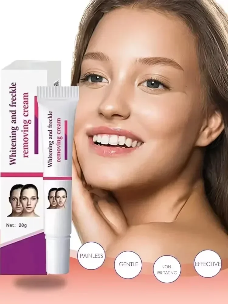 Effective Whitening Freckle Cream Remove Melasma Cream Remove Dark Spots Melanin Moisturize Brighten Smooth Face Skin Care