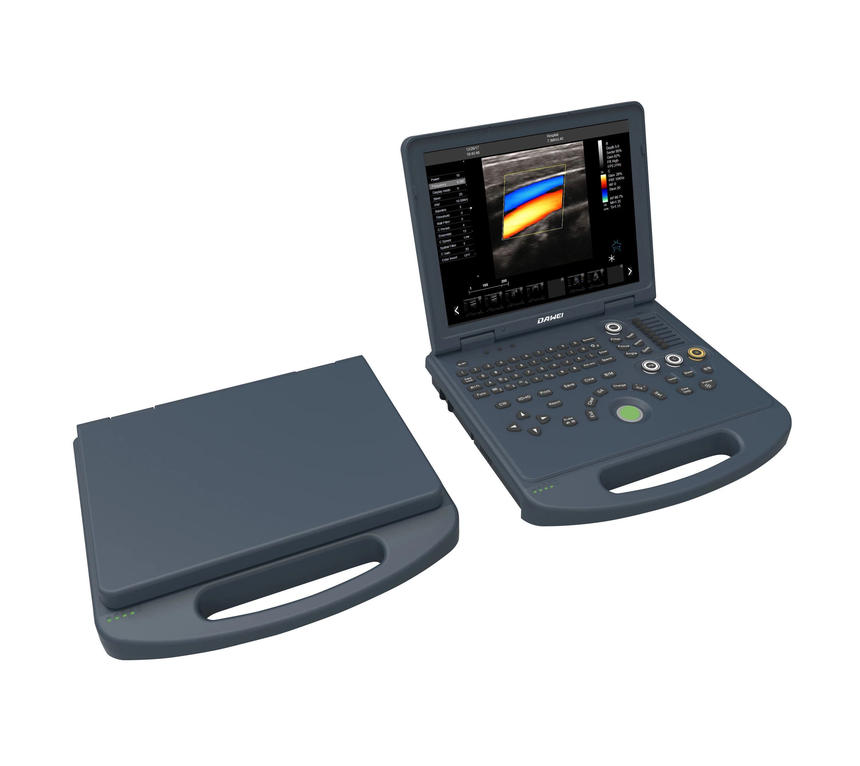 Ecografo portatil ultrasound 15 LED  laptop portable color doppler ultrasound