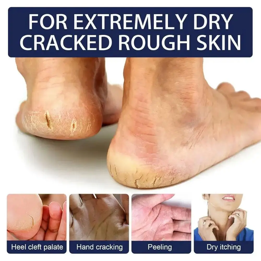 Horse Oil Hand And Foot Cream Anti Dry Crack Repair Hand Nourishing 300g Heel Exfoliating Feet Cream Moisturizing Care Balm