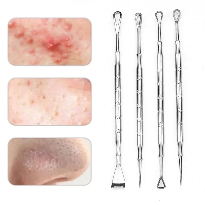 1-5pc Blackhead Remover Pimple Popper Tool Acne Needle Removing Treatment Whitehead Popping Zit Nose Face Blemish Extractor Tool