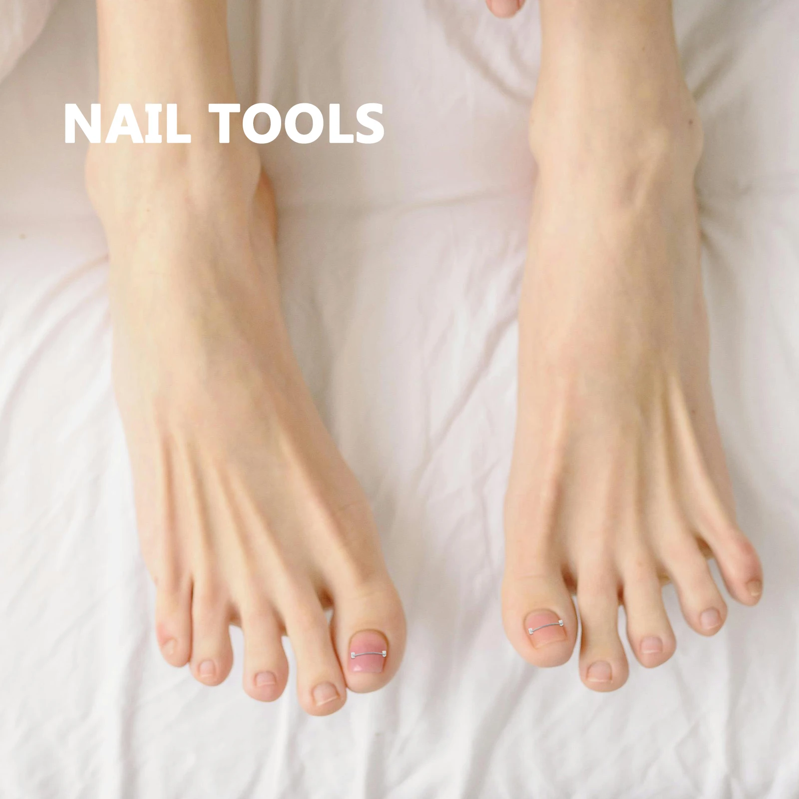 5 pezzi trattamento unghia incarnita set di cavi in lega di titanio riparazione unghie curve strumenti per pedicure kit di correzione unghie del piede