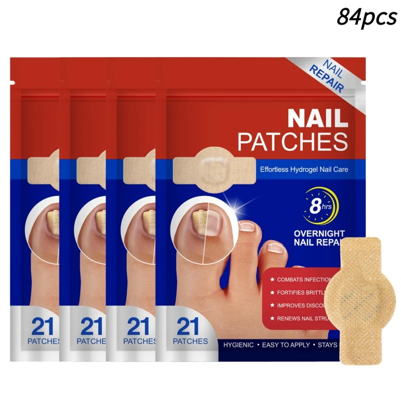 84 Stuks Teennagel Schimmel Patches Waterdichte Nagel Reparatie Patches Nagel Ingegroeide Correctie Stickers Voor Verkleurde Of Beschadigde Nagels