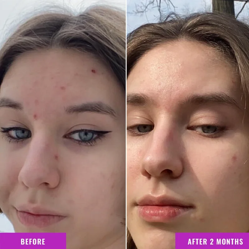 Niacinamide Pet Facial Essence - Niacinamide Brightening Serum 评论和价格