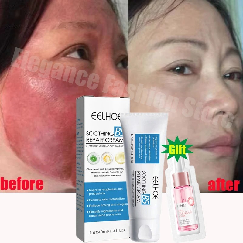 Cicaplast Repair Cream B5 40ml Moisturizer Repair Cream Soothes Redness Itching Nourishes Improve Repair Sunscreen Cream