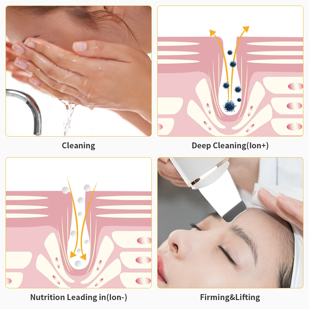 EMS Ultrasonic Skin Scrubber Deep Face Cleansing Machine Peeling Shovel Facial Pore Cleaner Blackhead Removal Lifting Device