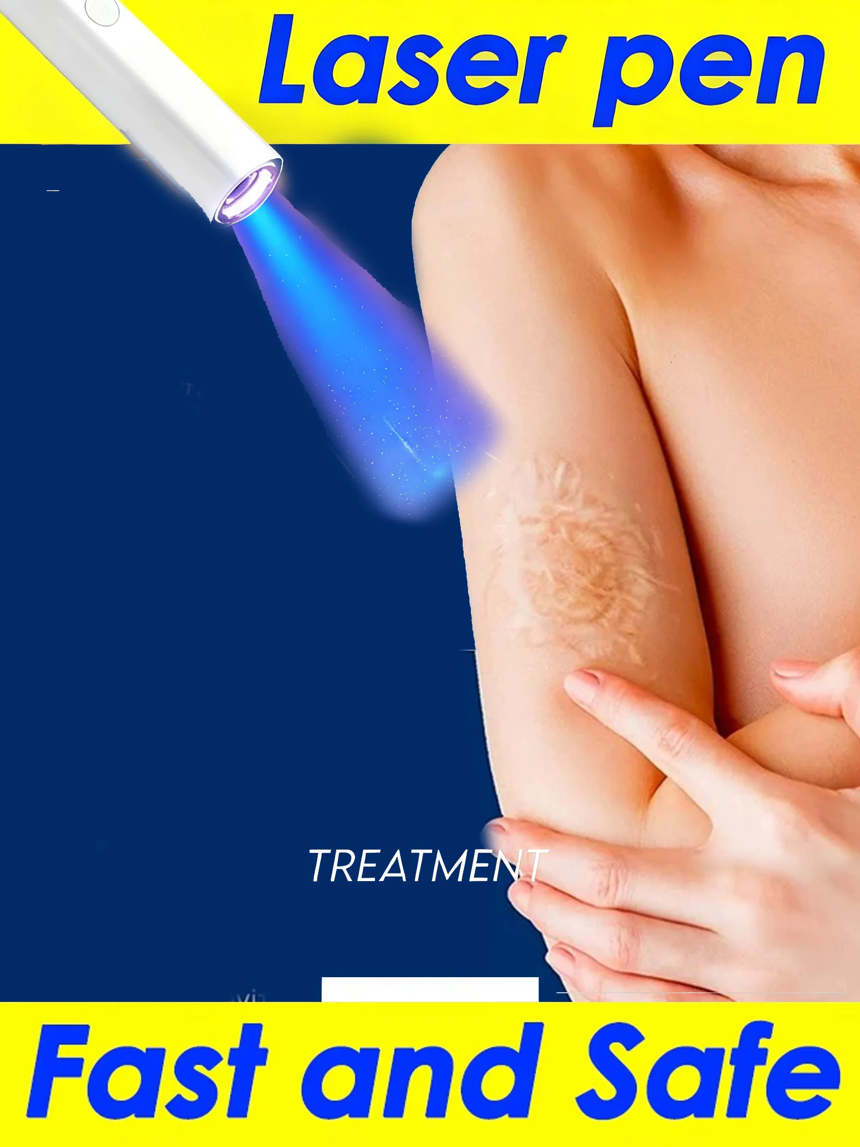 

Blue light laser pen, specially designed for scars, making scars disappear without a trace