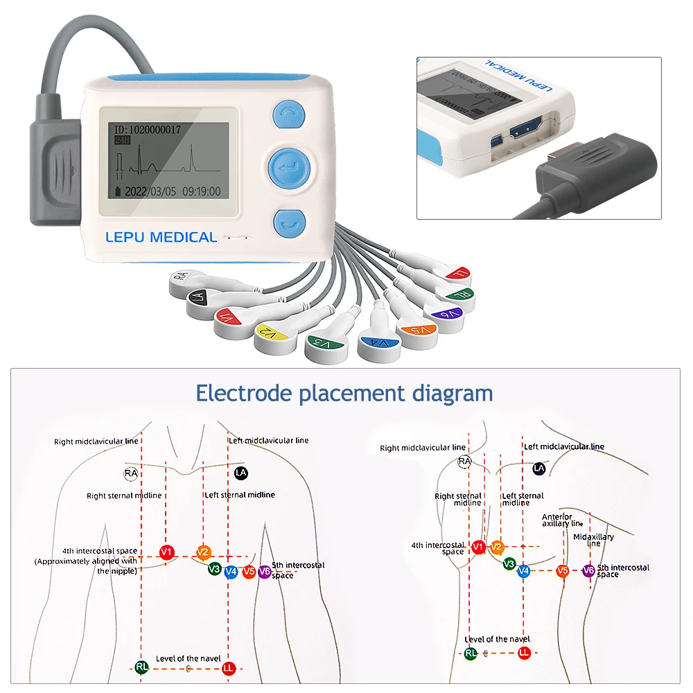 Medical Wearable 12 Leads Holter Monitor AI Smart Dynamic Analysis System Machine Ecg Device 24H EKG Recording free PC Software