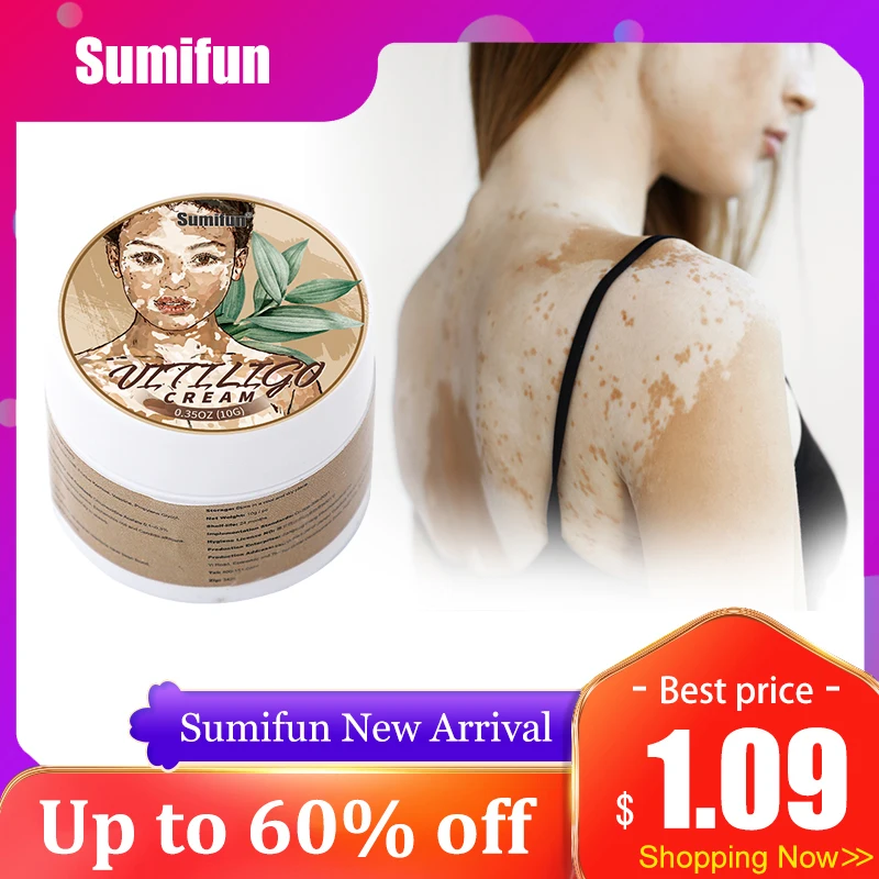 

10g Sumifun Vitiligo Treatment Cream Lotion White Spot Fungus Remover Back Skin Disease Ointment Chinese Medicine Health Care