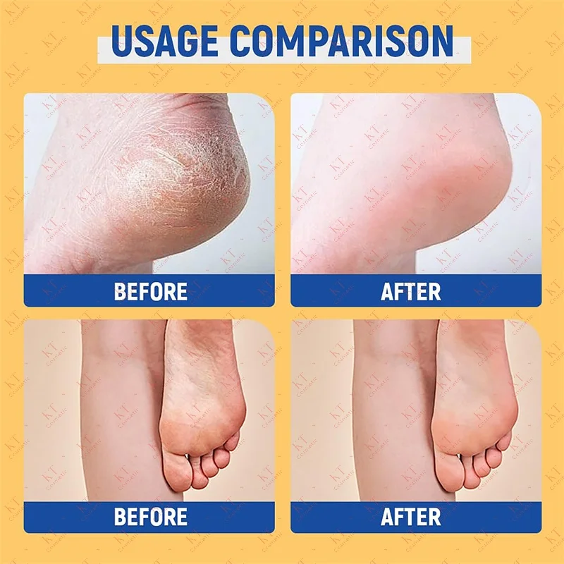 

60% Urea Peach Foot Cream Stick - Moisturizing & Exfoliating, Cracked Heel Repair, Deep Hydration for Dry Feet, Long protect.