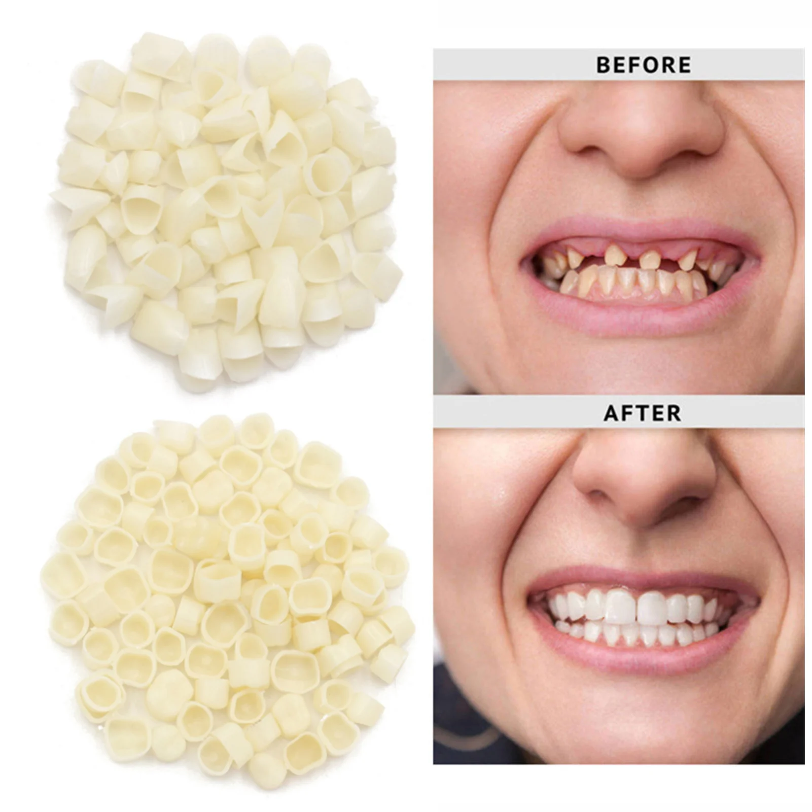 Temporary Dental False Teeth Cover Anterior Molar Front/Back Tooth White Caps for Women Men Retouching Tooth Hole