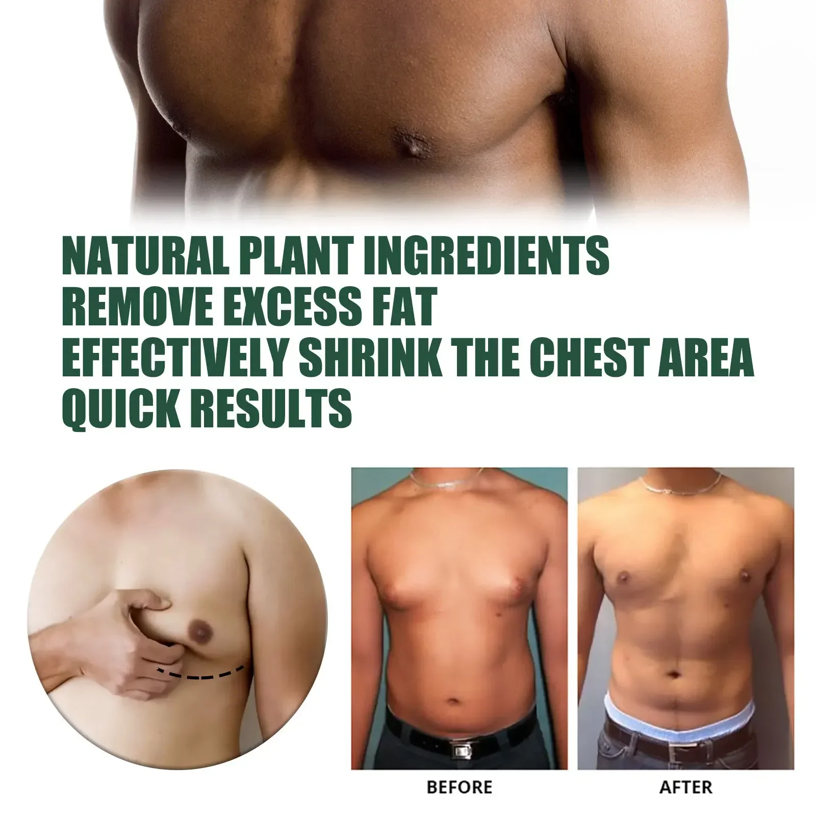 Man Breast Firm Massage Cream Ginger Serum Remove Excess Fat Effective Shrink Chest Gynecomastia Tighten Essence Oil Cream 30ml