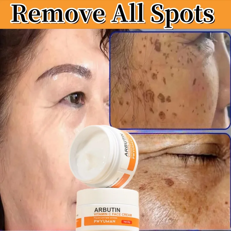

Whiten Freckle Cream Vitamin C Remove Melasma Melanin Correcter Anti-Pigmentation Dark Spot Fade Improve Dullness Skin Care
