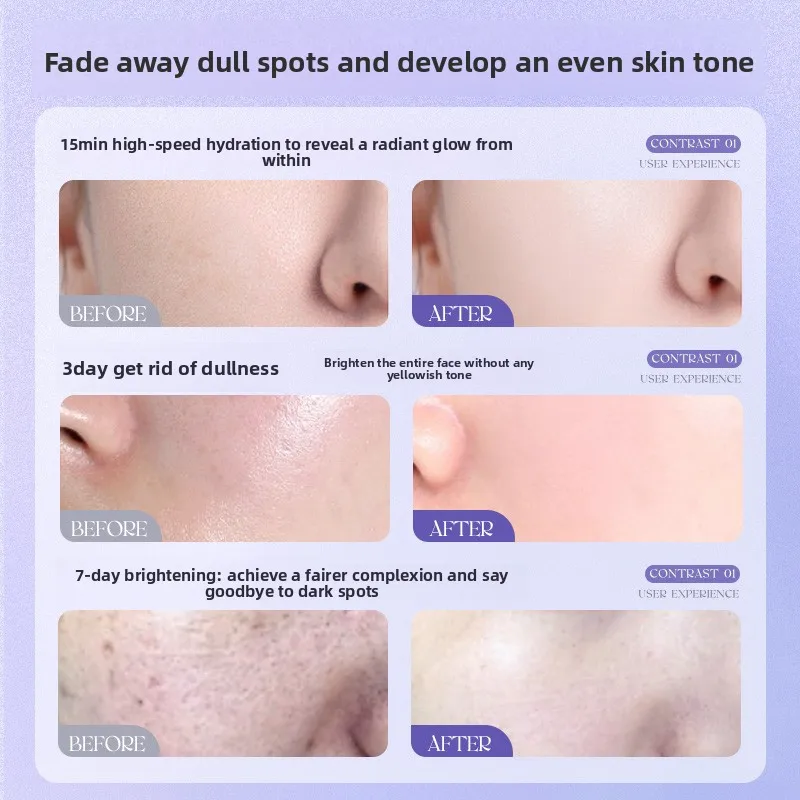 OHBT Nnicotinamide المضادة للتجاعيد مصل المسام تقلص الوجه ثبات النفط مصل تبييض ترطيب مصل الصباغ البقع إزالة #4