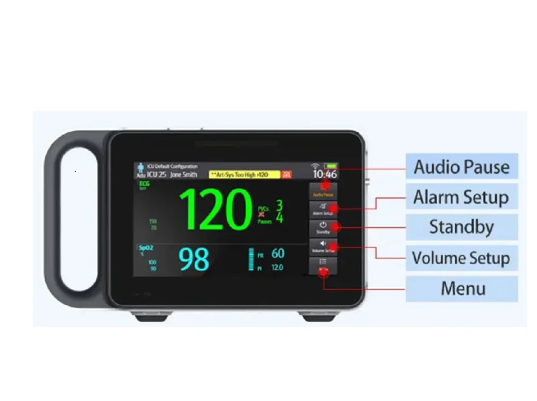 شاشة محمولة تعمل باللمس جهاز مراقبة المريض ، 6 معلمات ، ECG ، NIBP ، RESP ، SPO2 ، PR ، TEMP ، 7 بوصة ، بشري وطبيب بيطري