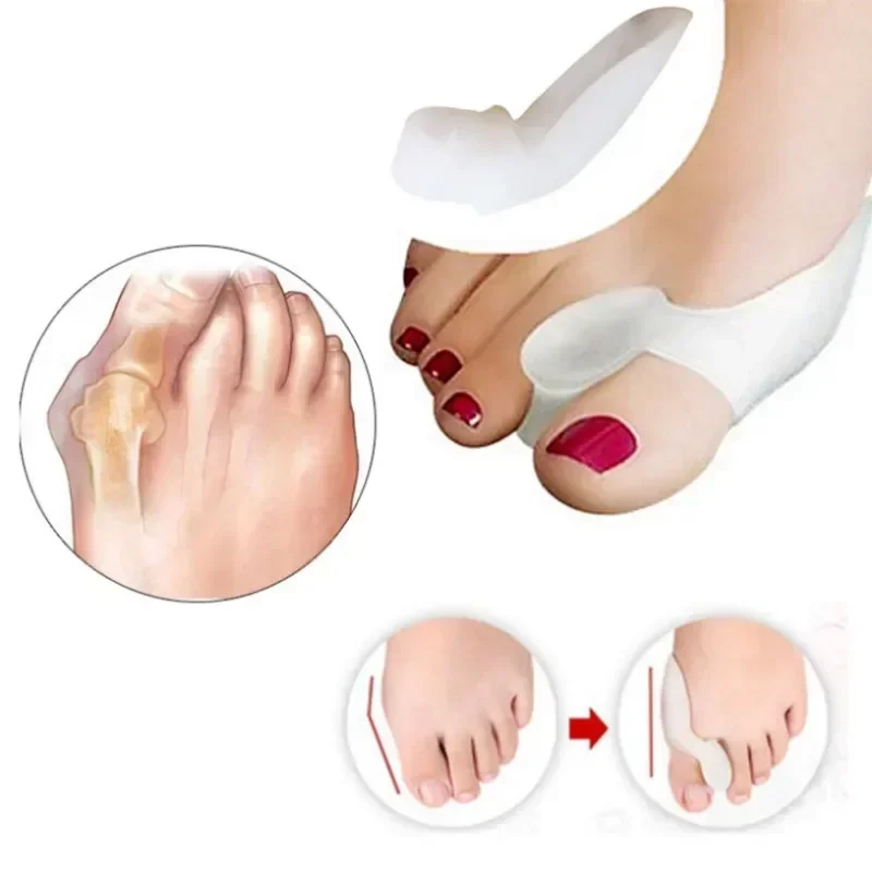 2PCS Gel Thumb Straightener Hallux Valgus Toe Separator Protector Finger Correction Strap Foot Care Assistive Tool for Relief