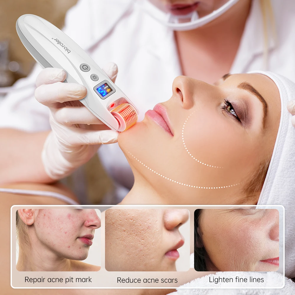 Cartuccia ad ago in titanio Bio roller G5 540 per viso corpo e cuoio capelluto Microneedling Beard Roller Derma Rolle