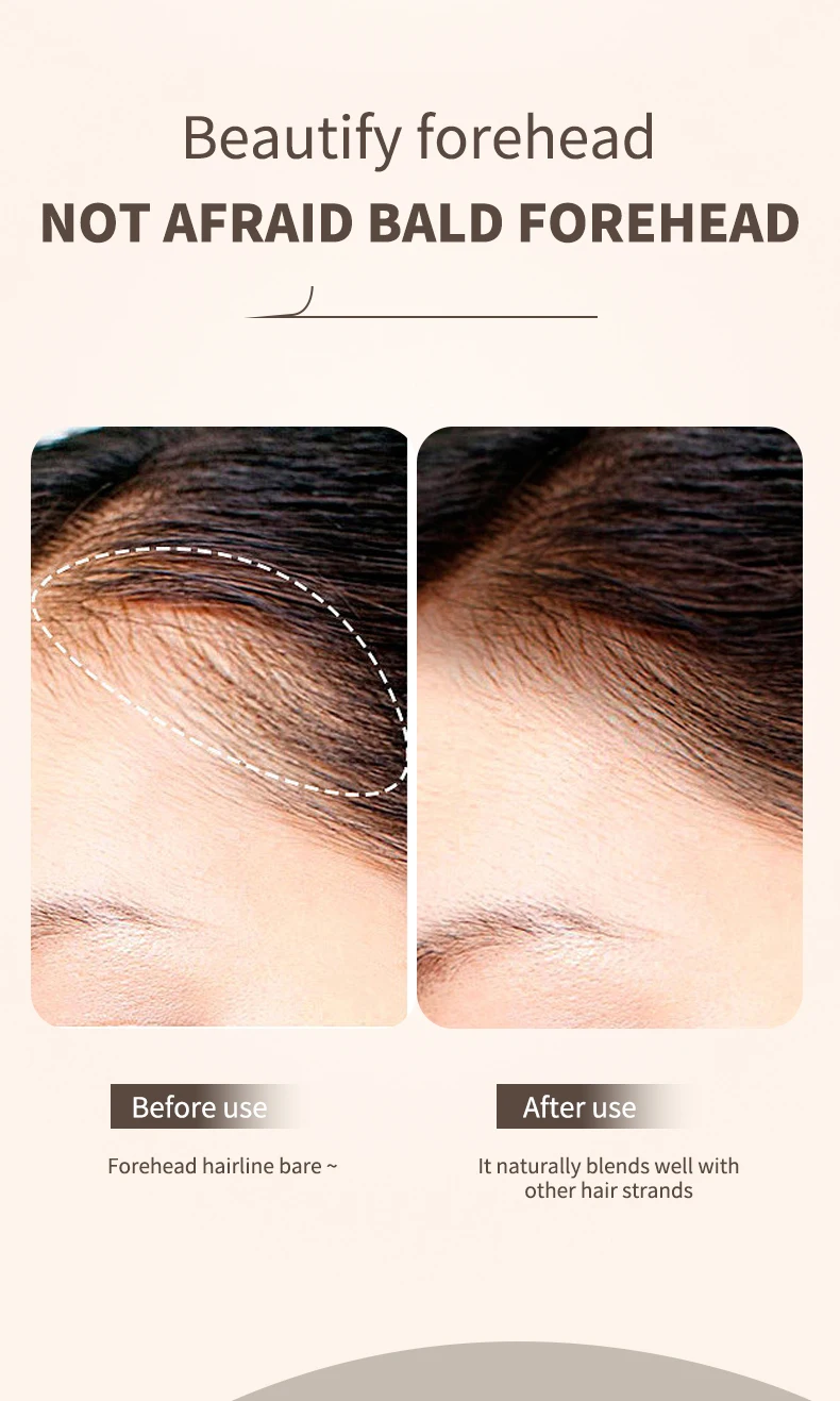 O'CHEAL Hairline Fluffy Powder Repair Volume Powder Shadow Shadow Powder Hair Concealer Coverage Fill Forehead Hairline – Detail 6