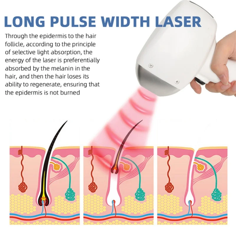 Macchina per la depilazione laser a diodi per apparecchiature di bellezza laser di nuovo design 808